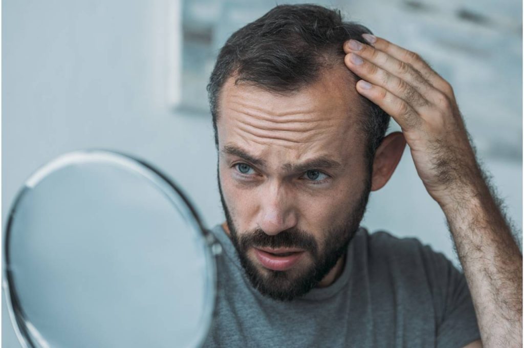 Queda de cabelo em homens: por que acontece?